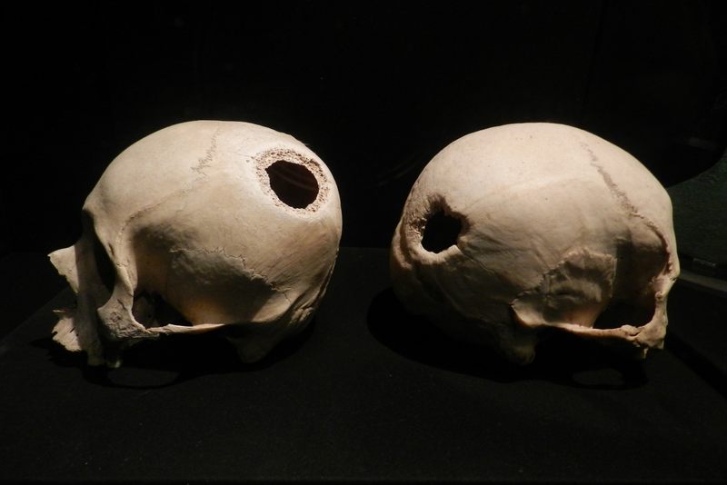 Cráneos trepanados en Perú