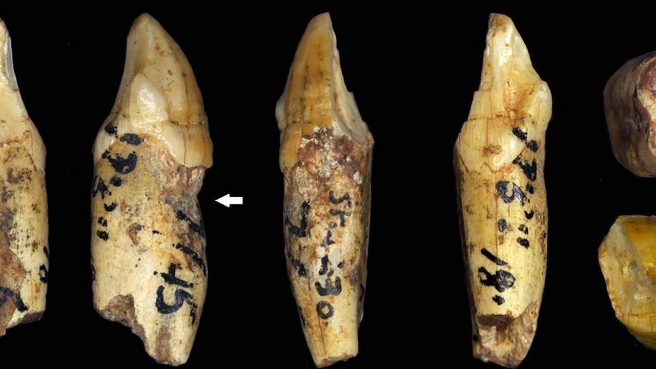 Antepasados ​​humanos tuvieron los mismos problemas dentales que nosotros