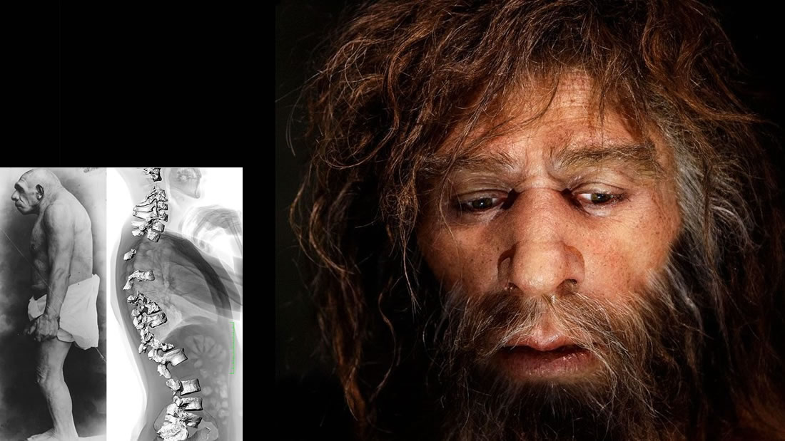 Los neandertales no eran encorvados: estudio revela que su postura era similar a la nuestra